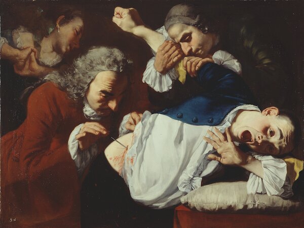 Gaspare Traversi, Die Operation, um 1754 &copy; Staatsgalerie Stuttgart